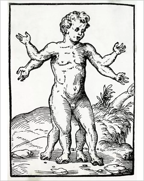 Multi-Limbed Child  /  1560