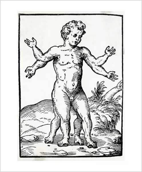 Multi-Limbed Child  /  1560