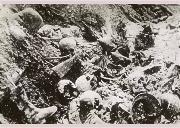 Ww1  /  1919  /  Trench Skeleton