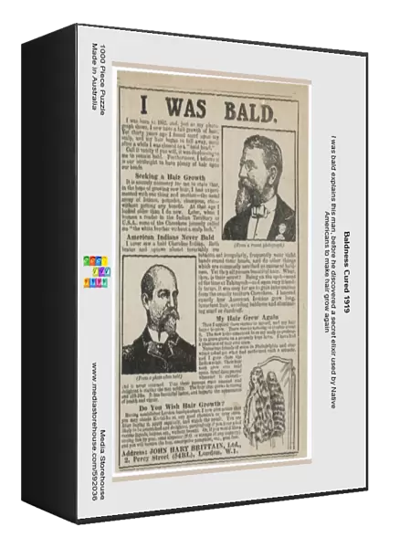 Baldness Cured 1919