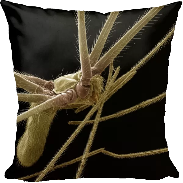 Scanning Electron Micrograph (SEM): Cellar or ‘Daddy-long-legs Spider, Magnification x 40 (A4 size: 29. 7 cm width)