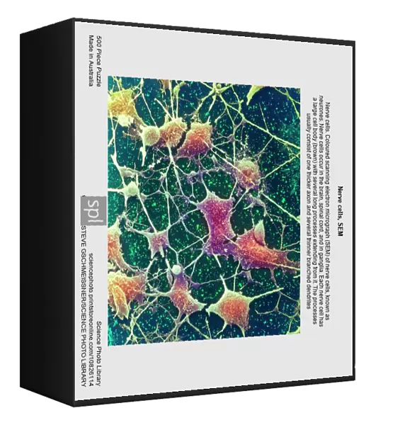 Nerve cells, SEM
