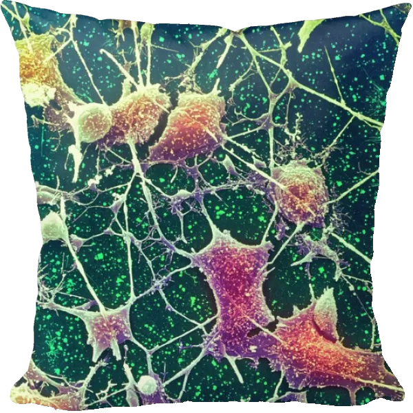 Nerve cells, SEM