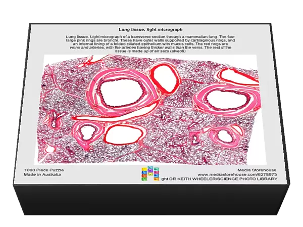Lung tissue, light micrograph