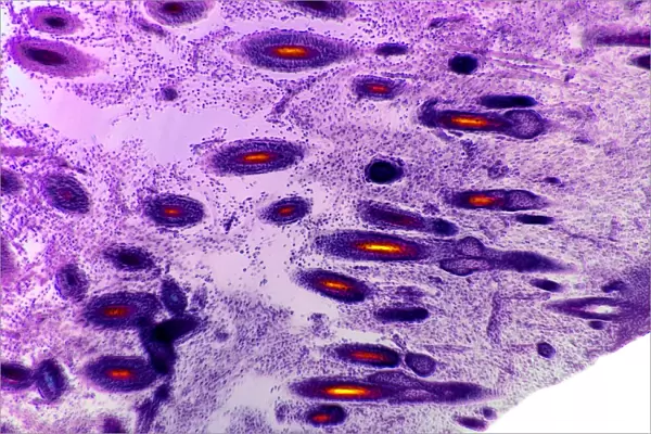 Scalp tissue, light micrograph