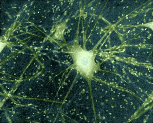 Motor neurons, light micrograph