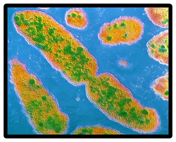 Serratia marcescens bacteria