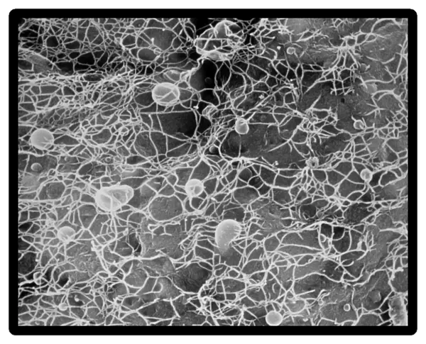 Protoplast showing cellulose microfibrils
