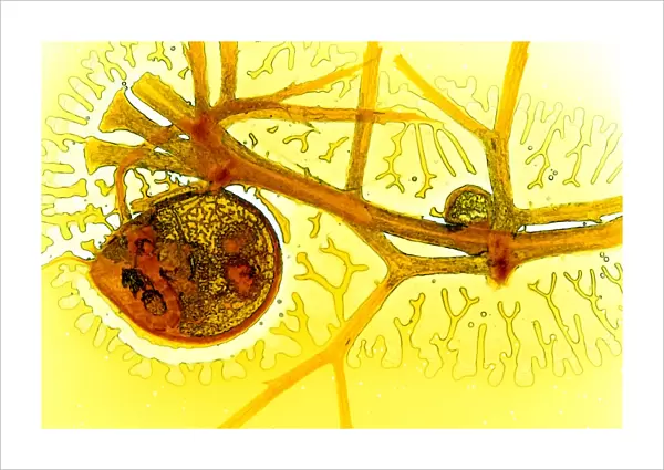 Bladderwort bladder, light micrograph