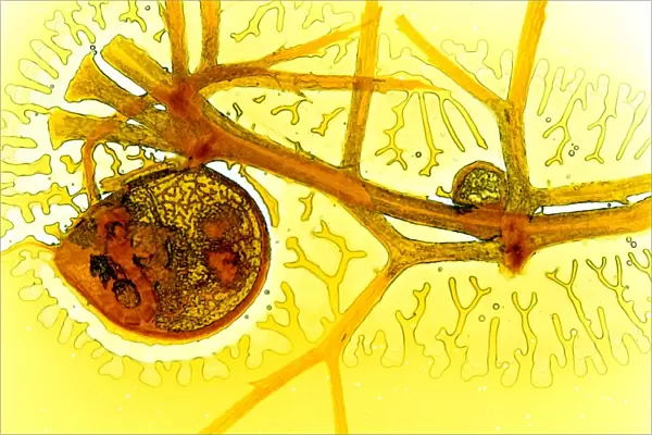 Bladderwort bladder, light micrograph