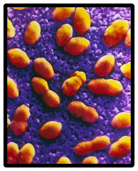Coloured SEM of streptococcus pneumoniae
