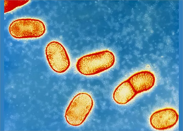 Bacteroides gingivalis bacteria