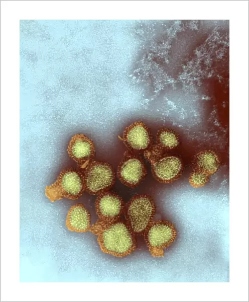 H5N3 influenza A virus particles, TEM