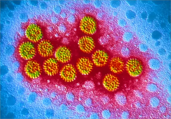 TEM of rotavirus particles