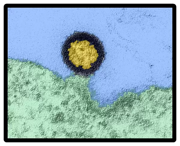 AIDS virus particle, TEM