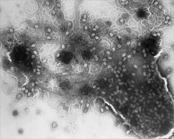 TEM of bacterial lysis due to T4 phage infection
