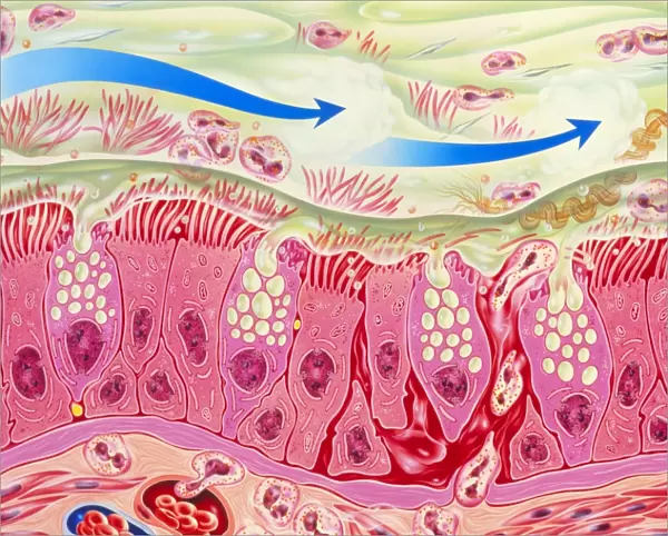 Artwork of inflamed bronchial epithelium in asthma