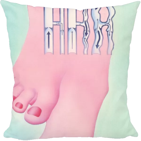 Artwork of legs with healthy and varicose veins