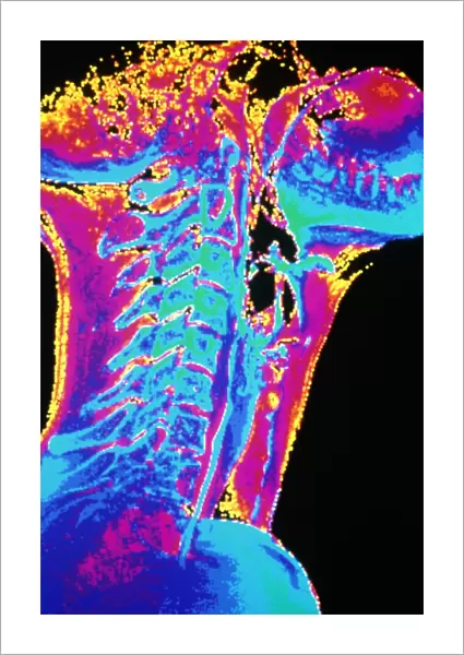 Coloured X-ray of a normal neck in profile