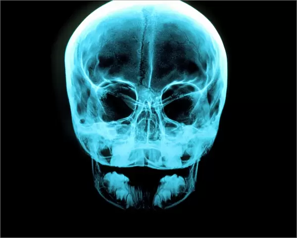 X-ray of human skull