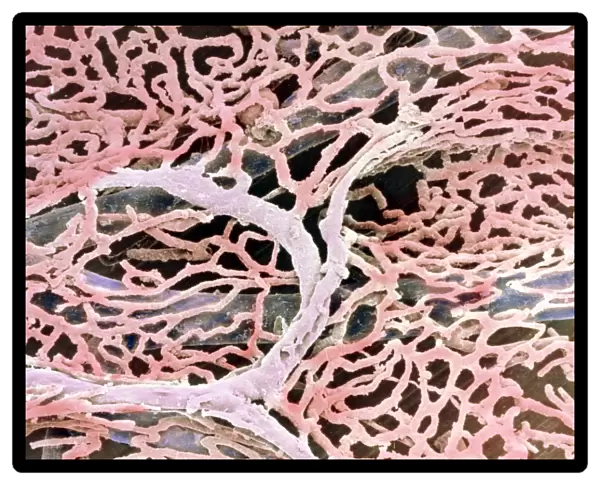 Coloured SEM of capillaries of the gall bladder
