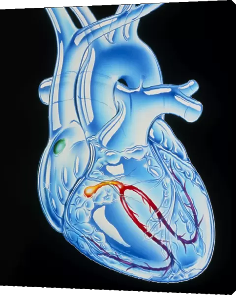 Illustration of electrical conduction in the heart