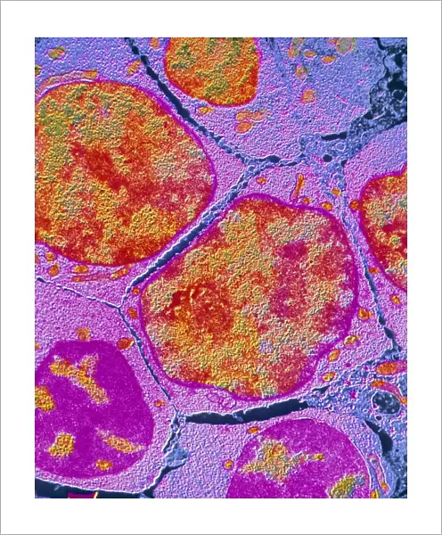 F  /  col TEM of erythroblast in bone marrow