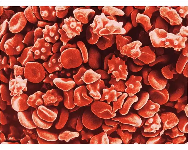 Coloured SEM of red blood cells (erythrocytes)