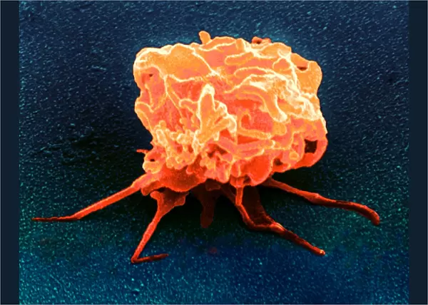 Coloured SEM of an activated blood platelet