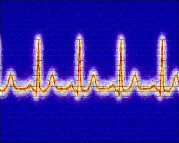 Computer artwork of healthy ECG trace of the heart