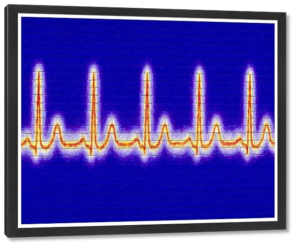 Computer artwork of healthy ECG trace of the heart