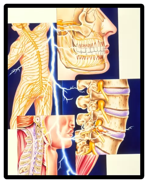 Artwork showing common sites of pain