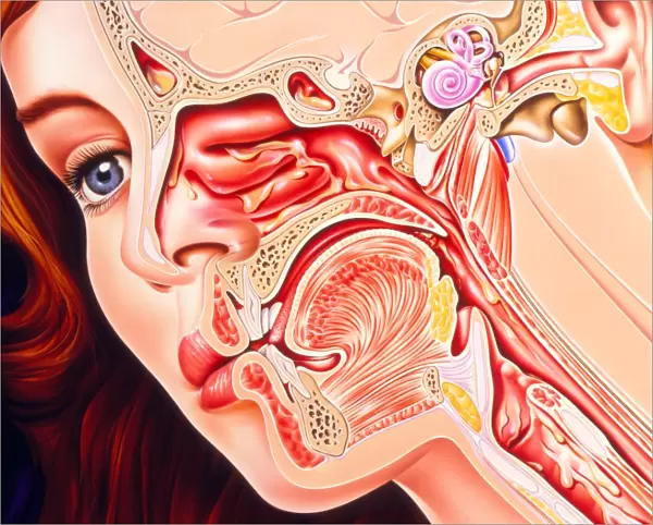 Artwork of ear, nose & throat in a cold sufferer