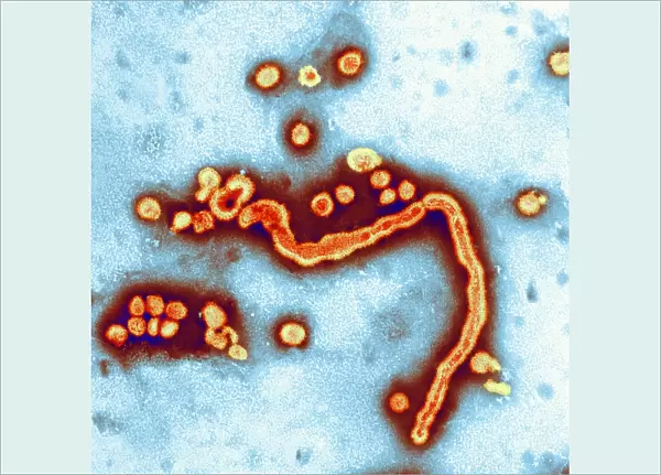 Influenzavirus A, TEM