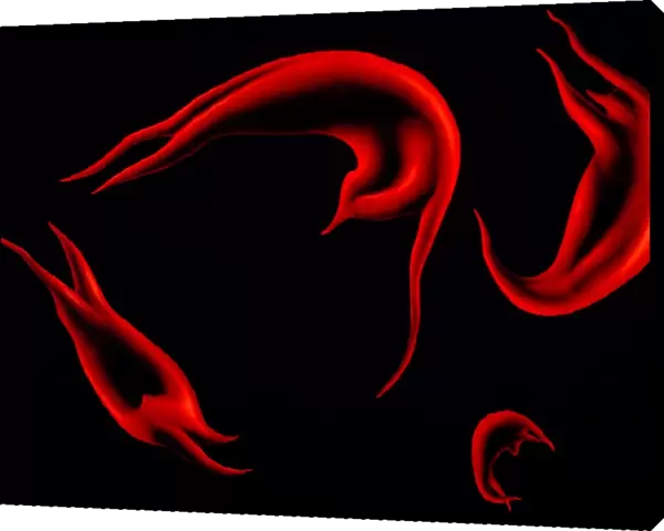 Artwork of red cells in sickle cell disease
