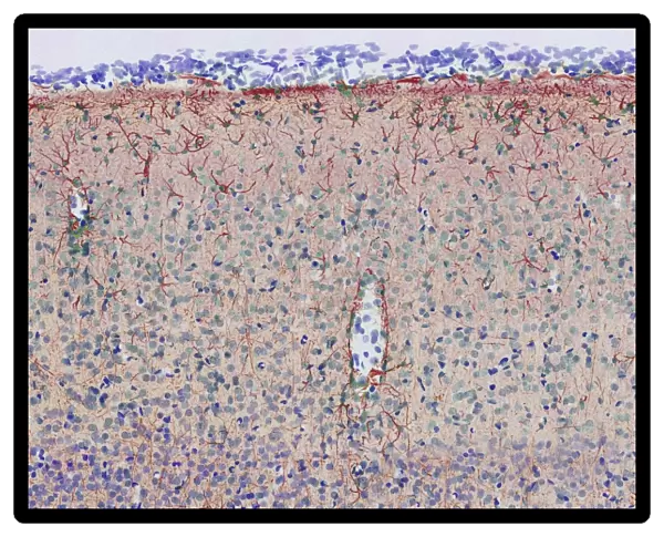 Brain cortex tissue, light micrograph