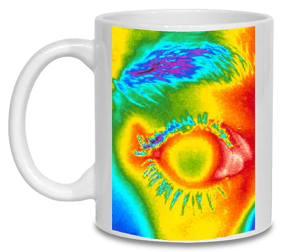 Thermogram of a close-up of a human eye