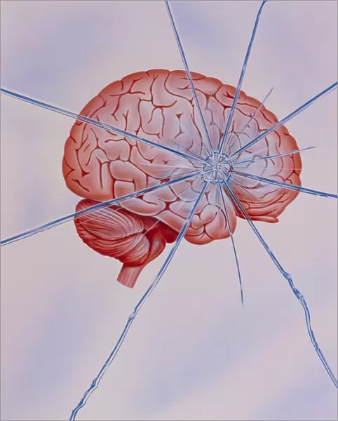 Artwork of brain with shattered glass superimposed