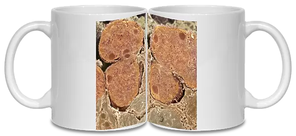 Pancreas cells, SEM