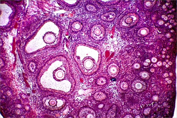 Follicles in a human ovary, micrograph