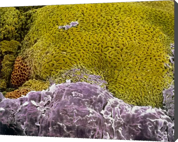 F  /  colour SEM of oesophagus-stomach transition zone