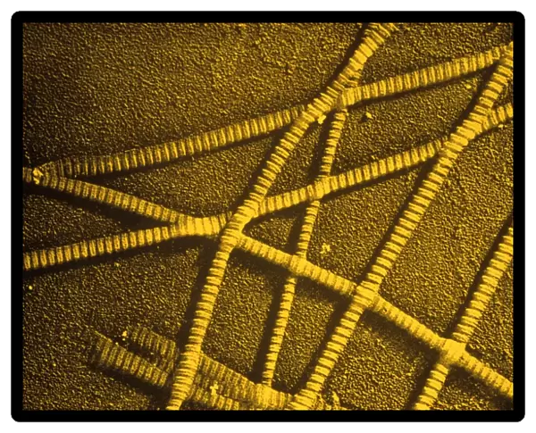 False-colour TEM of collagen fibres