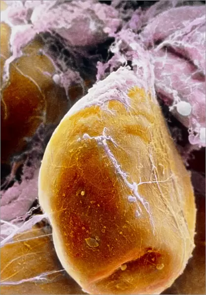 False-colour SEM of a fat cell (adipocyte)