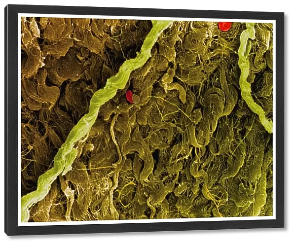 Coloured SEM of collagen connective tissue fibres