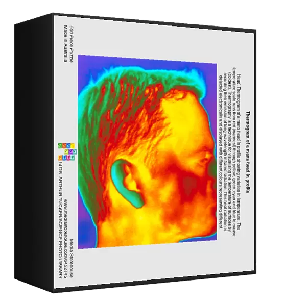 Thermogram of a mans head in profile