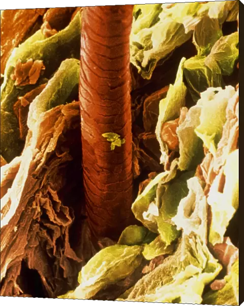Coloured SEM of a hair emerging from the skin