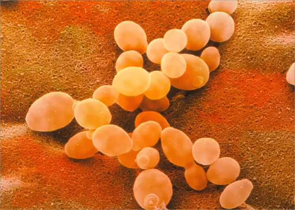 Yeast, Saccharomyces cerevisiae