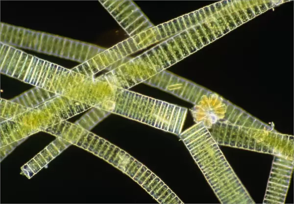 LM of the colonial diatom Fragillaria sp
