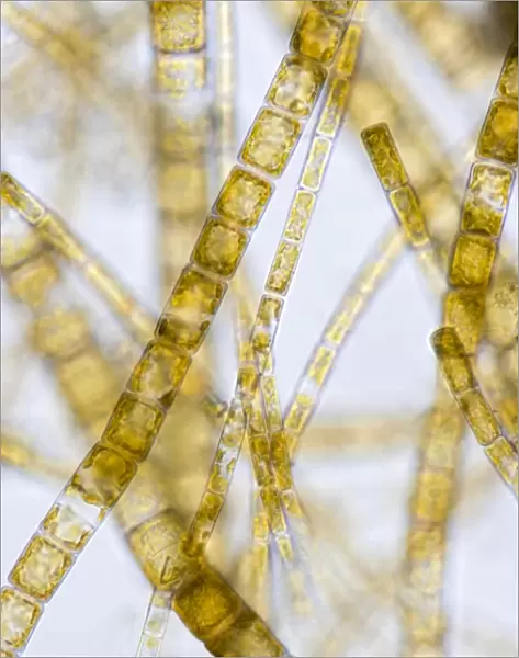 Melosira filamentous diatom alage, LM