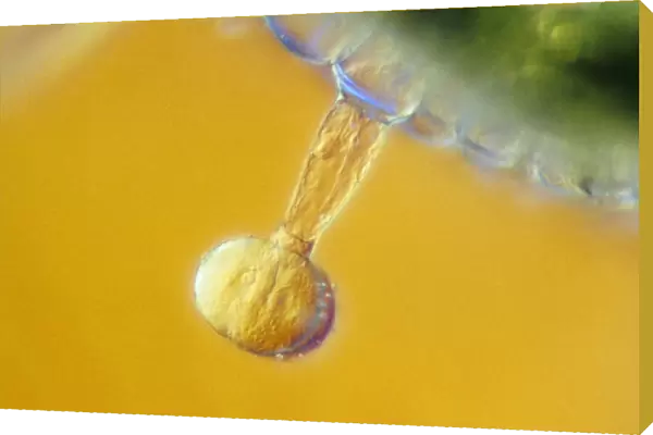 LM of tomato trichomes
